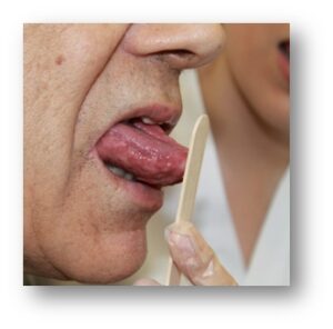 Dott.ssa Monica Patrucco, logopedista, spiega il disturbo della disartria